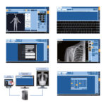 VRX 12-D Mobile X-Ray System